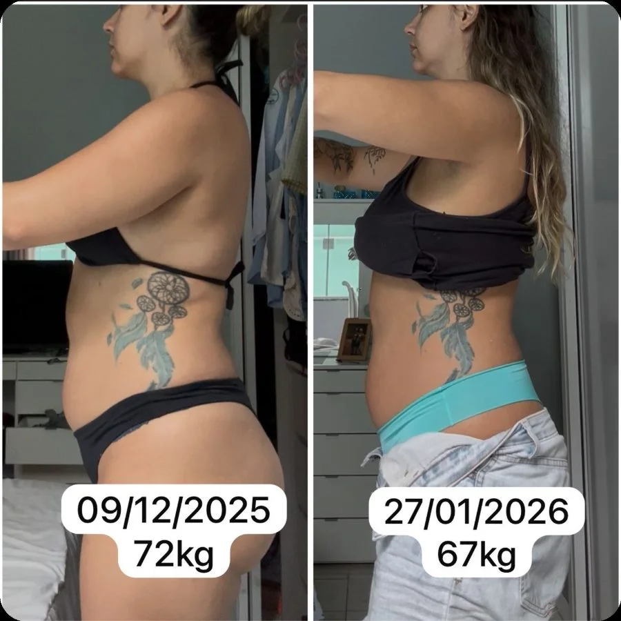Antes e depois Juliana