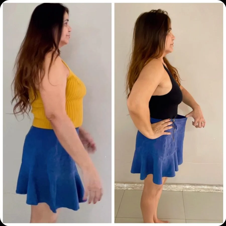 Antes e depois Mirelli